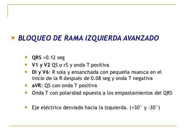 Bloqueo de rama izquierda signos y sintomas